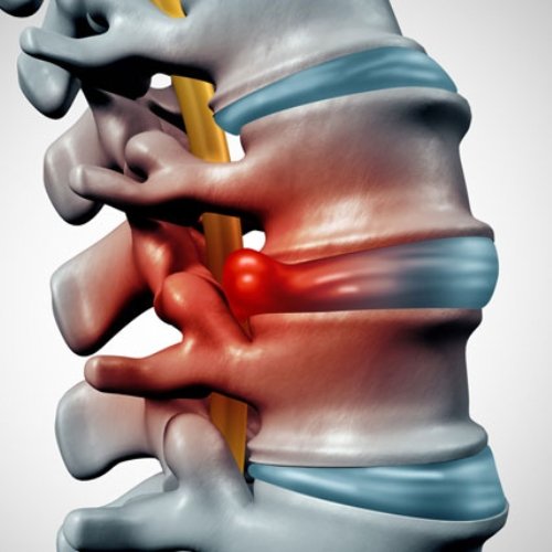 Understanding Trigeminal Neuralgia: Effective Treatment Options